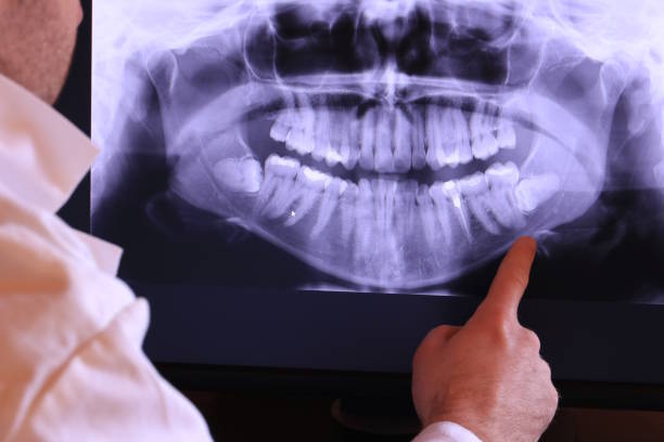 Best Emergency Dentist for Lost Fillings or Crowns in Alliae, NC